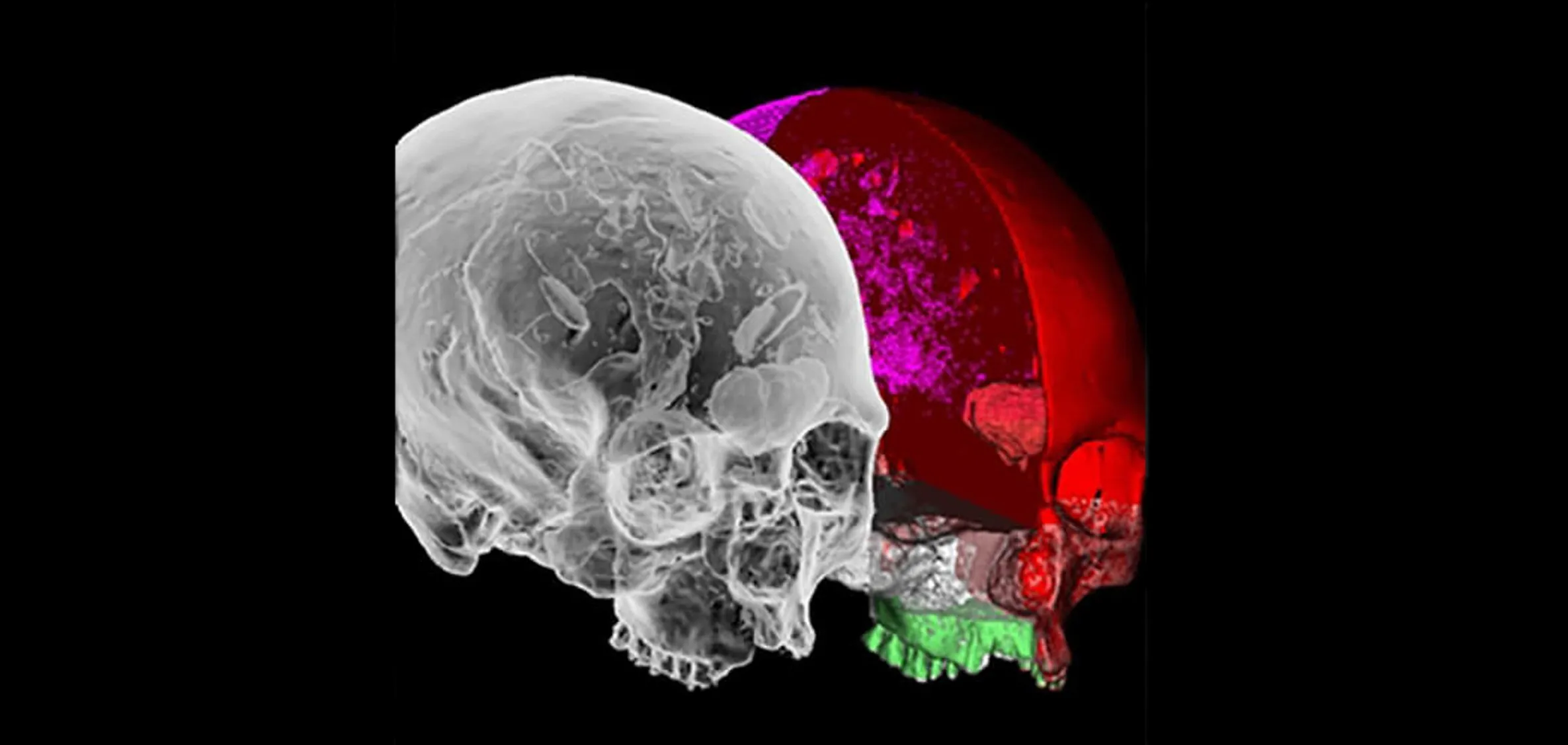 Image of skulls